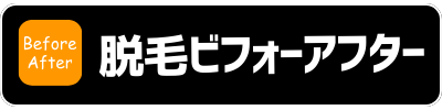 脱毛ビフォーアフター
