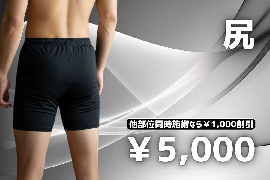 尻脱毛 他部位同時施術なら¥1,000割引